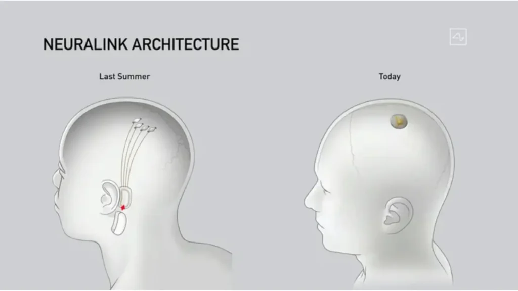 Neuralink technology