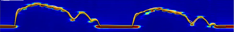 TFM B-scan thickness profile with smooth surface tracking and high index-axis resolution.